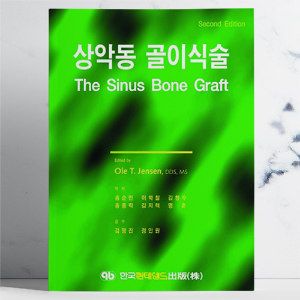 상악동 골이식술 (The Sinus Bone Graft Second Edition)