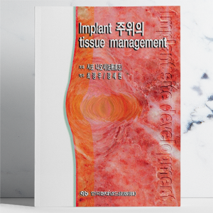 Implant 주위의 tissue management