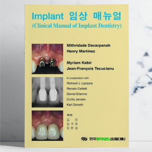 Implant 임상매뉴얼